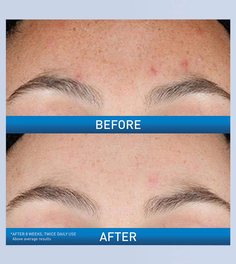 SERUM DE RETINOL PARA LA RENOVACION FACIAL 30 ml