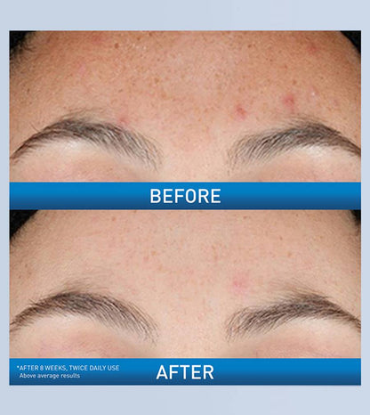 SERUM DE RETINOL PARA LA RENOVACION FACIAL 30 ml